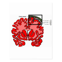 Meninges Tarjeta Postal