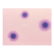 Micoplasma gramnegativo Hominis Postales