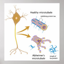 Microtubules de desintegración en el poster de Alz