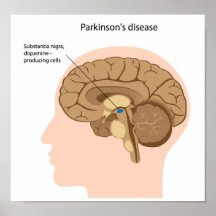 Poster de la enfermedad de Parkinson