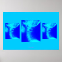 Poster de la quiropráctica: Azules cervicales late