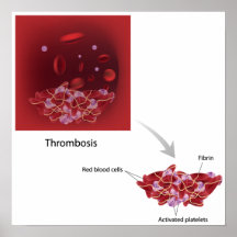 Poster de la trombosis