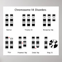 cromosoma 18