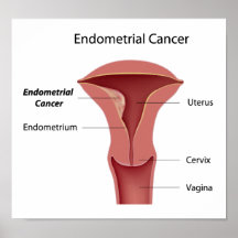 Poster del cáncer endometrial