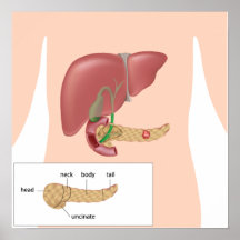 Poster del cáncer pancreático
