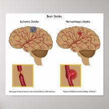 Poster del movimiento del cerebro