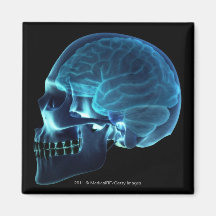 Radiografía del cerebro dentro de un cráneo imán para frigorífico
