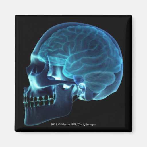 Radiografía del cerebro dentro de un cráneo imán para frigorífico