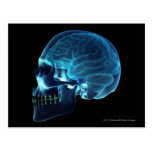 Radiografía del cerebro dentro de un cráneo tarjetas postales