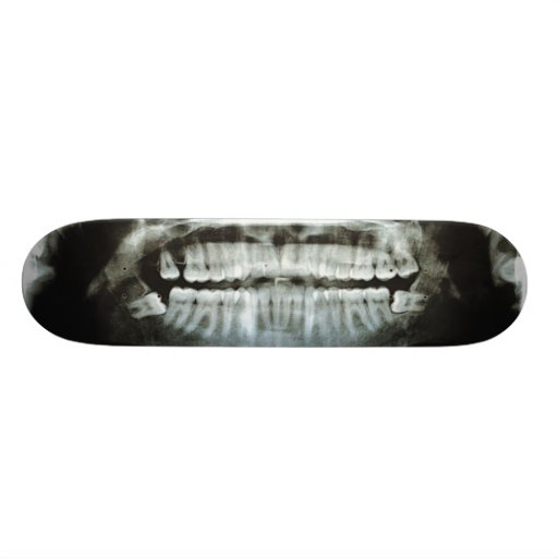 Radiografía Patines