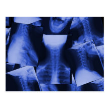 Radiografiado - azul electromágnetico postales