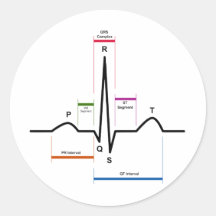 Ritmo del sino en un diagrama del electrocardiogra etiqueta
