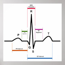 Ritmo del sino en un diagrama del electrocardiogra posters