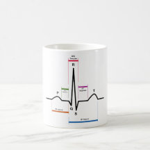 Ritmo del sino en un diagrama del electrocardiogra taza