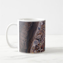 "Sensación: ¡Taza de café del ganglio de raíz dors