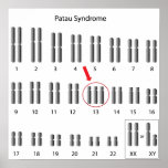 Síndrome de Patau, poster del trisomy 13