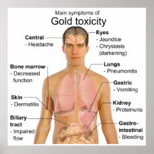 Síntomas principales de la toxicidad del oro en ca poster