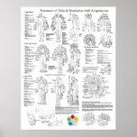 Tratamiento de la acupuntura del dolor y de los do posters