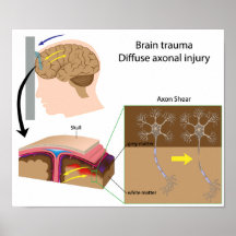 Trauma del cerebro con el poster del esquileo del 