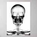 Buscar radiología posters Xray