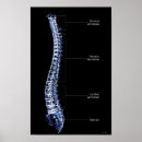 Buscar columna vertebral posters Pequeña empresa