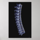 Buscar columna vertebral posters Pequeña empresa