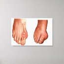 Buscar anatomía lienzos Cuerpo humano