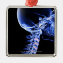 Buscar radiografías adornos Imagen