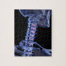 Buscar cuello humano posters Imagen de rayos x