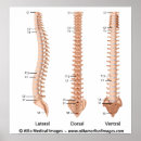 Buscar columna vertebral posters Espina dorsal