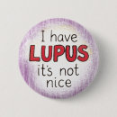 Buscar cuchara chapas Para ella