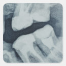 Buscar radiografía postales Parte del cuerpo humano