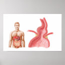 Buscar estómago posters Vesícula biliar