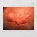 Buscar embrión postales Preñez