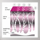 Buscar herp posters Herpes zóster
