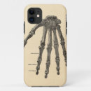 Buscar del médico iphone fundas Anatomía