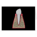Buscar esmalte dental Dientes