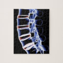 Buscar radiografía puzzles Parte del cuerpo humana