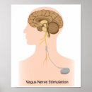 Buscar craneal arte Cerebro