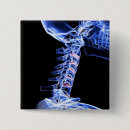 Buscar cuello chapas Vertical