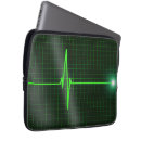 Buscar electrocardiograma Eléctrico