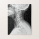 Buscar radiografía puzzles Médico
