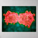 Buscar hematología posters Oncología
