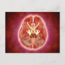 Buscar nervioso postales Imagen