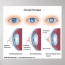 Buscar herp posters Virus