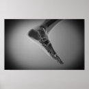 Buscar rayos x posters Anatomía