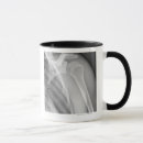 Buscar hueso humano tazas Blanco y negro