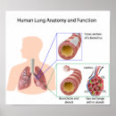 Buscar pulmonar arte Salud