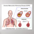 Buscar enfermedad humana posters Anatomía