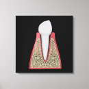 Buscar muela posters Dientes